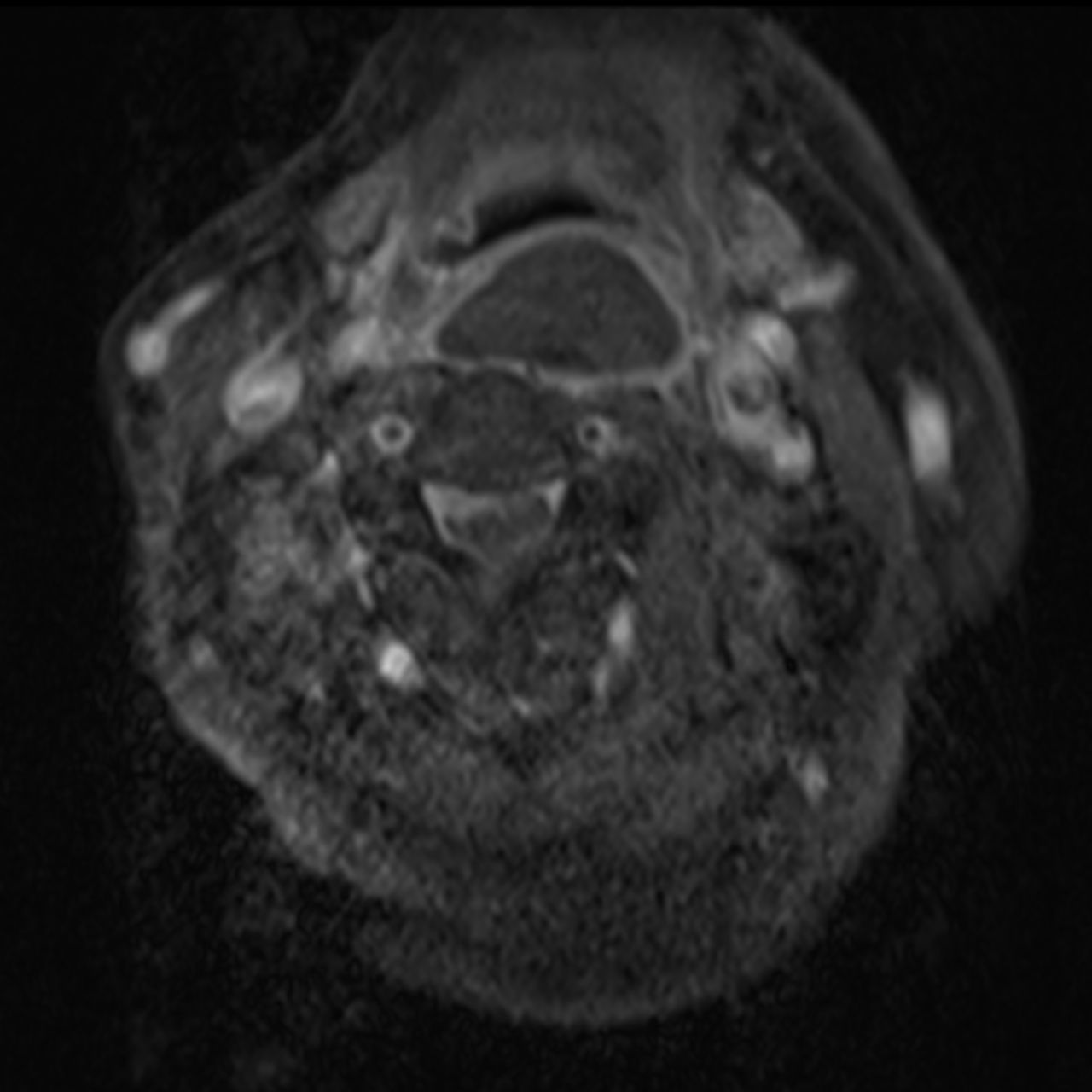 David Tafur Muñoz-2414