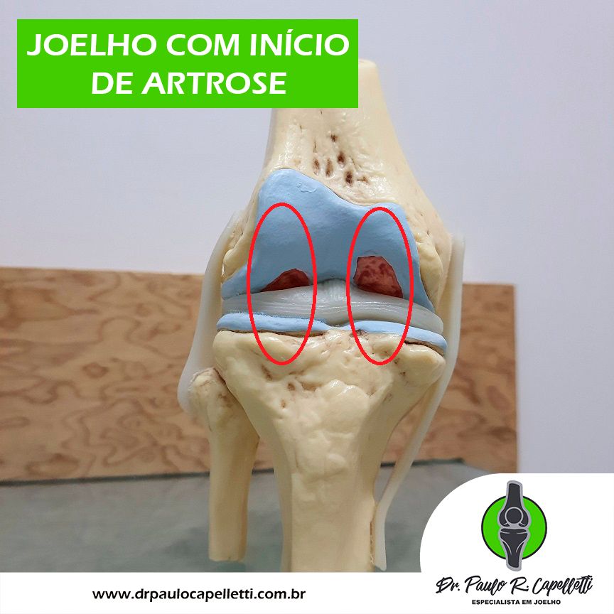 Paulo Roberto Capelletti-62