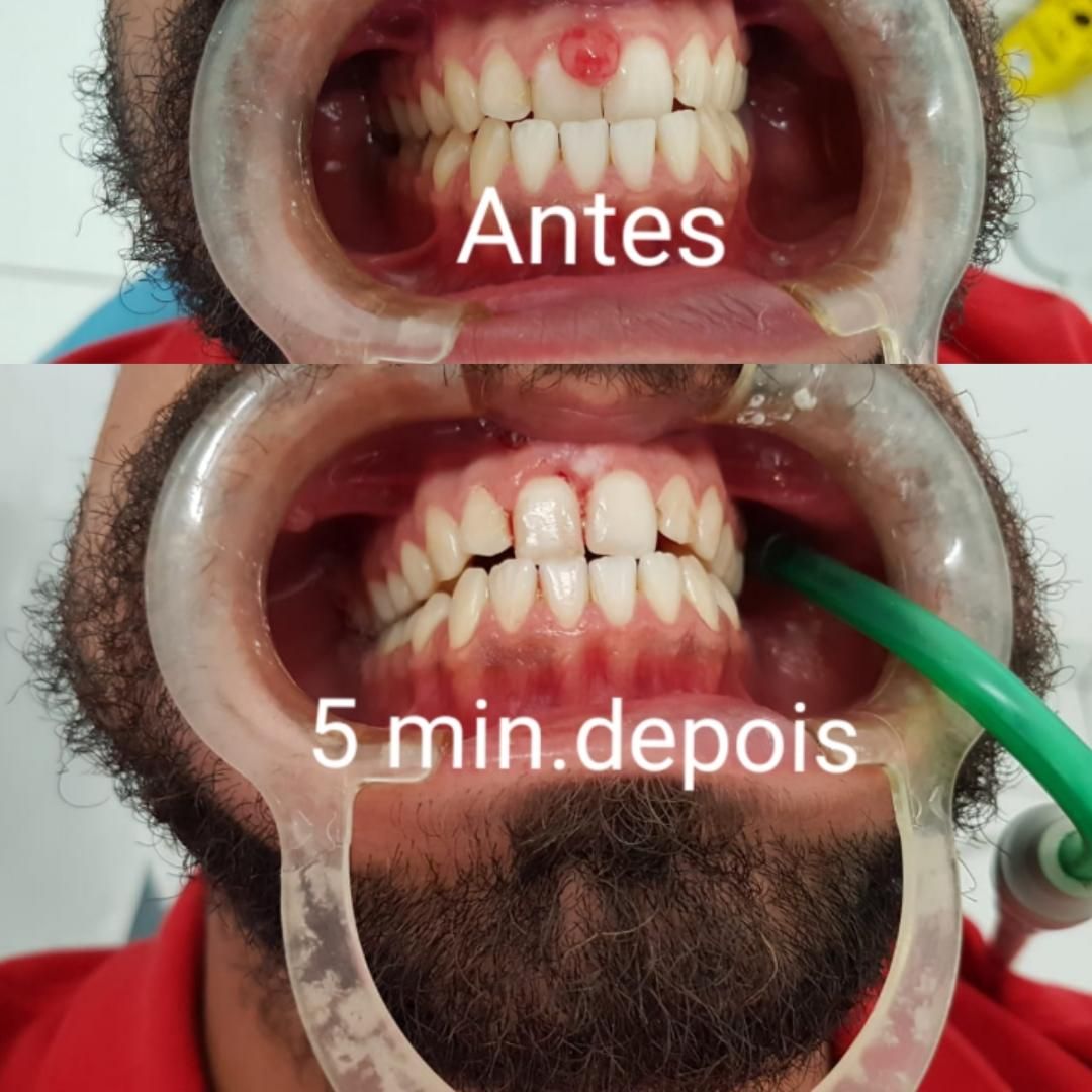 Alexandre Giannini-9