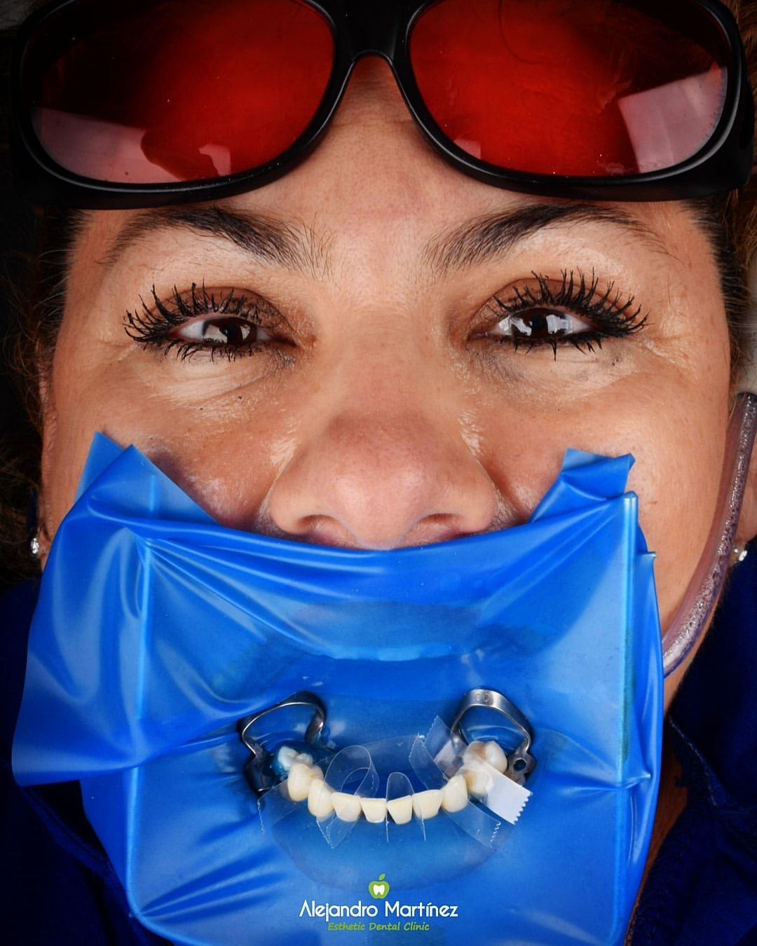 Alejandro Martinez-14