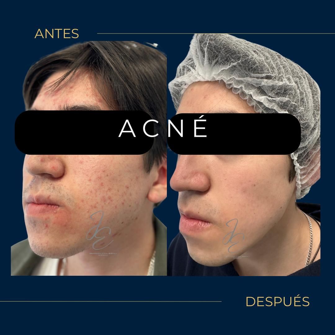 Jeanny Epieyu Diaz-3