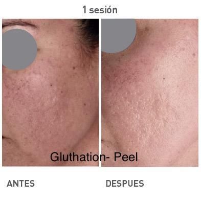 Maria Gisela Angel Losada-61