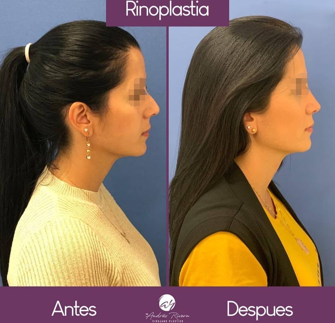 Andrés Rivera López-57