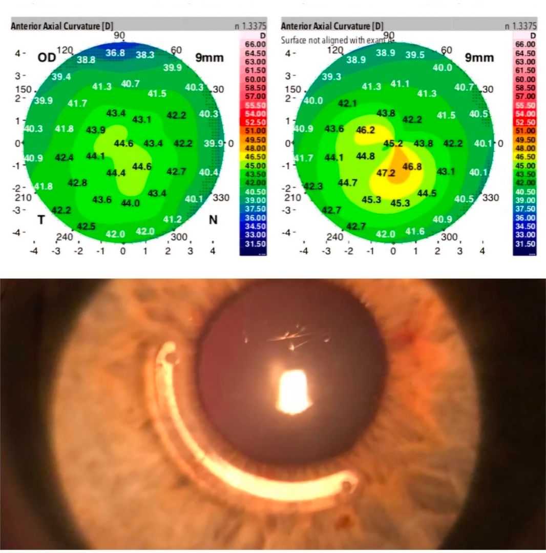Patrick Figueiredo-6