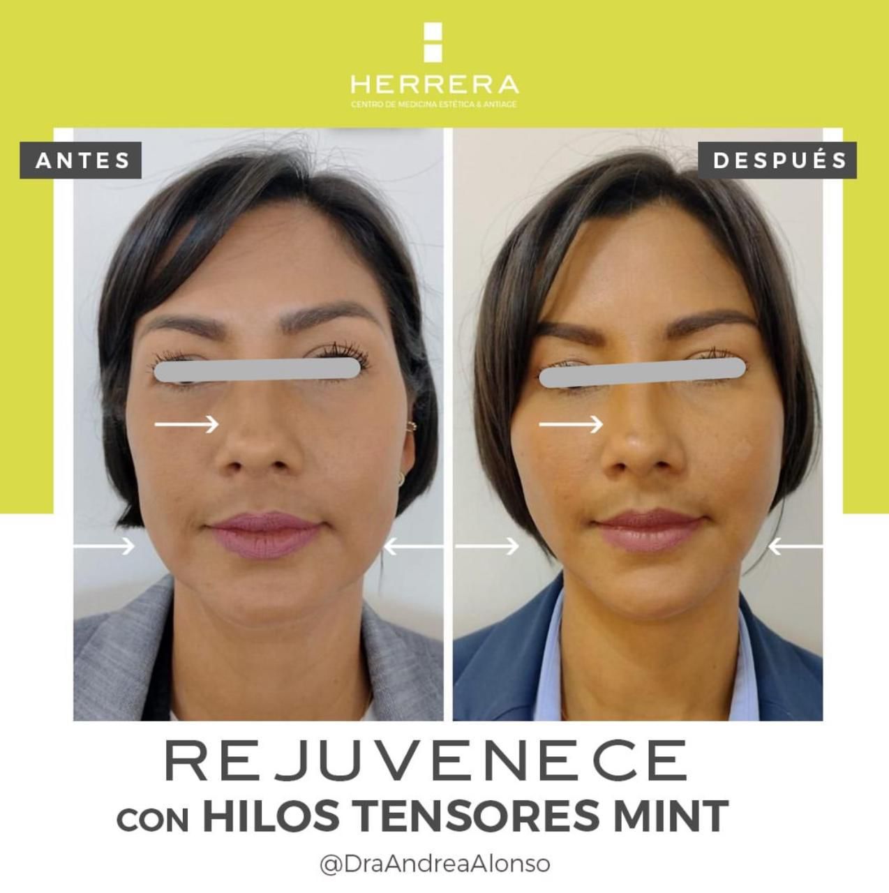 Andrea Alonso Herrera-8