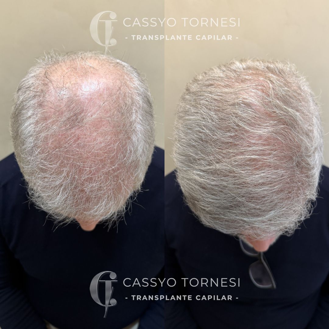 Cassyo Tornesi-27