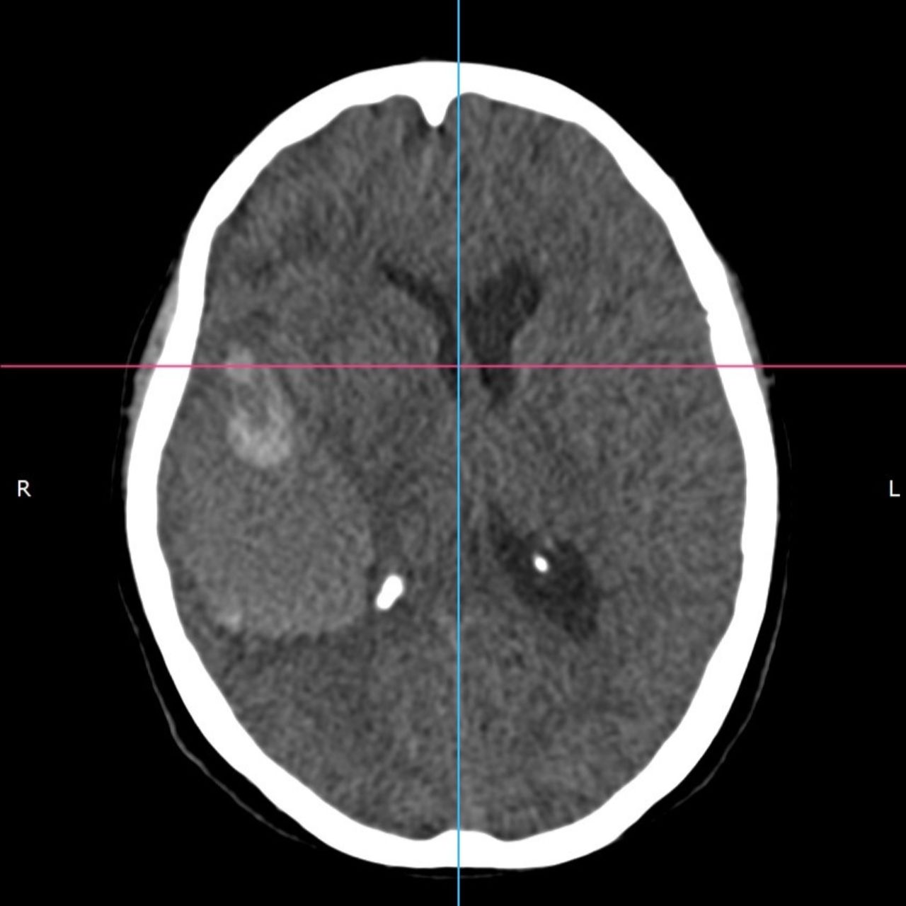 David Tafur Muñoz-1924