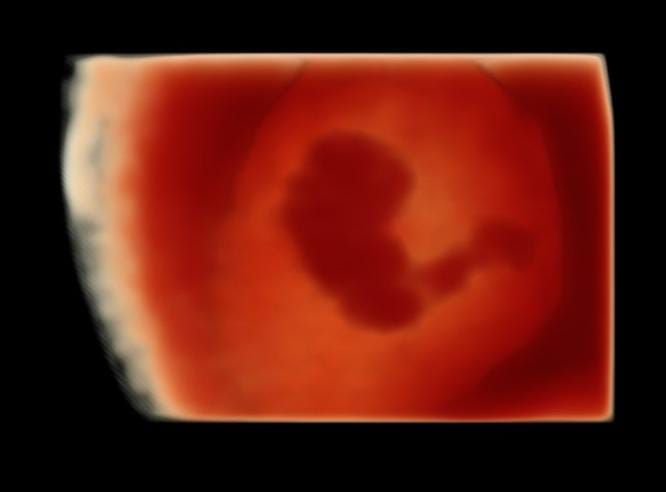 Lady Tatiana Duarte Lopez-6