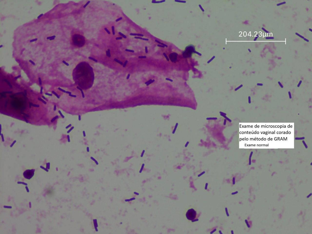 Julia Mandelbaum Bianchini-0