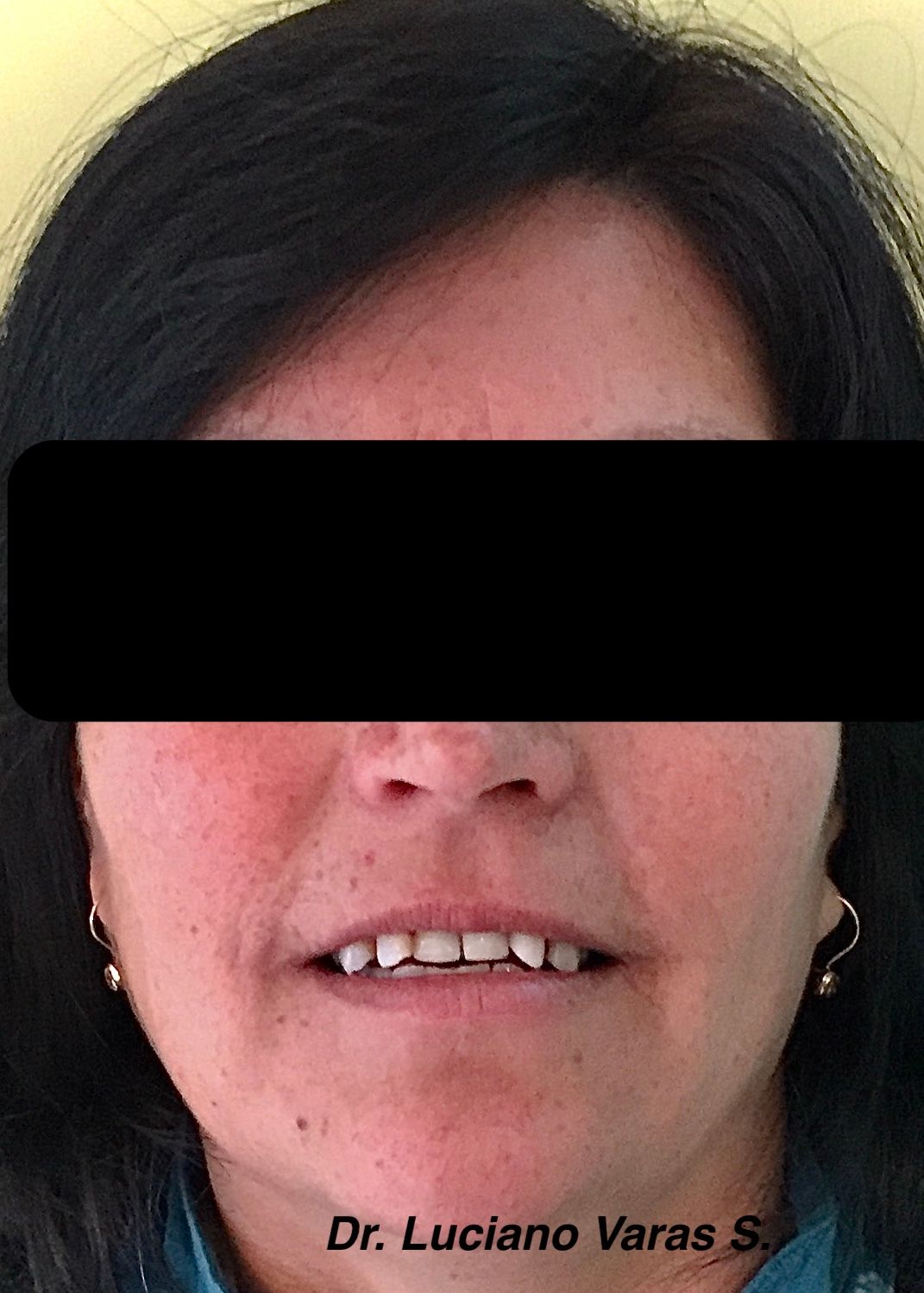 Luciano Varas Salinas-4