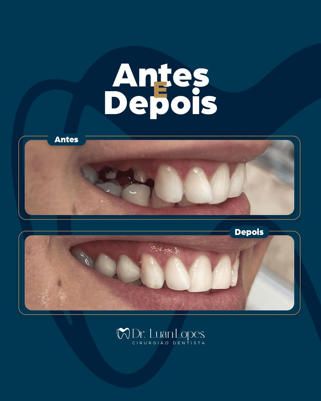 Luanderson Lopes Pereira-9