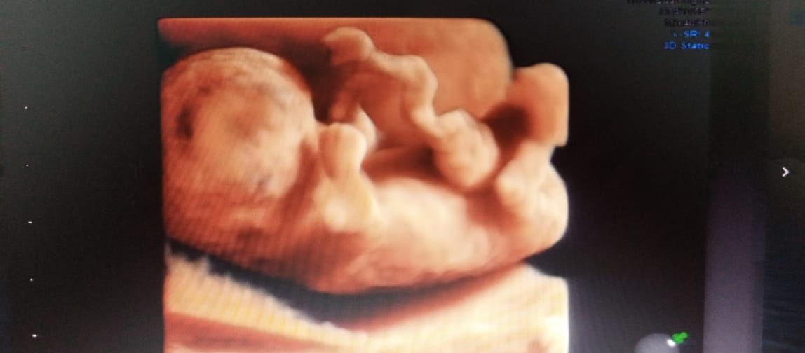 Cesar Vicente Albornoz Moreira-6