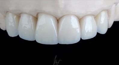 Juan Camilo Castillo-11