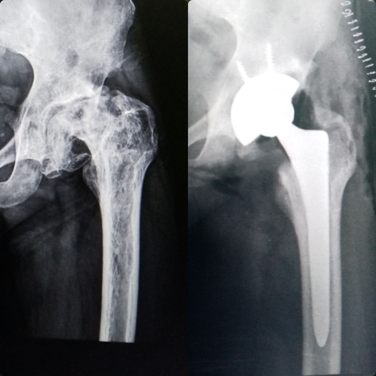 Carlos Escalante Saavedra-22