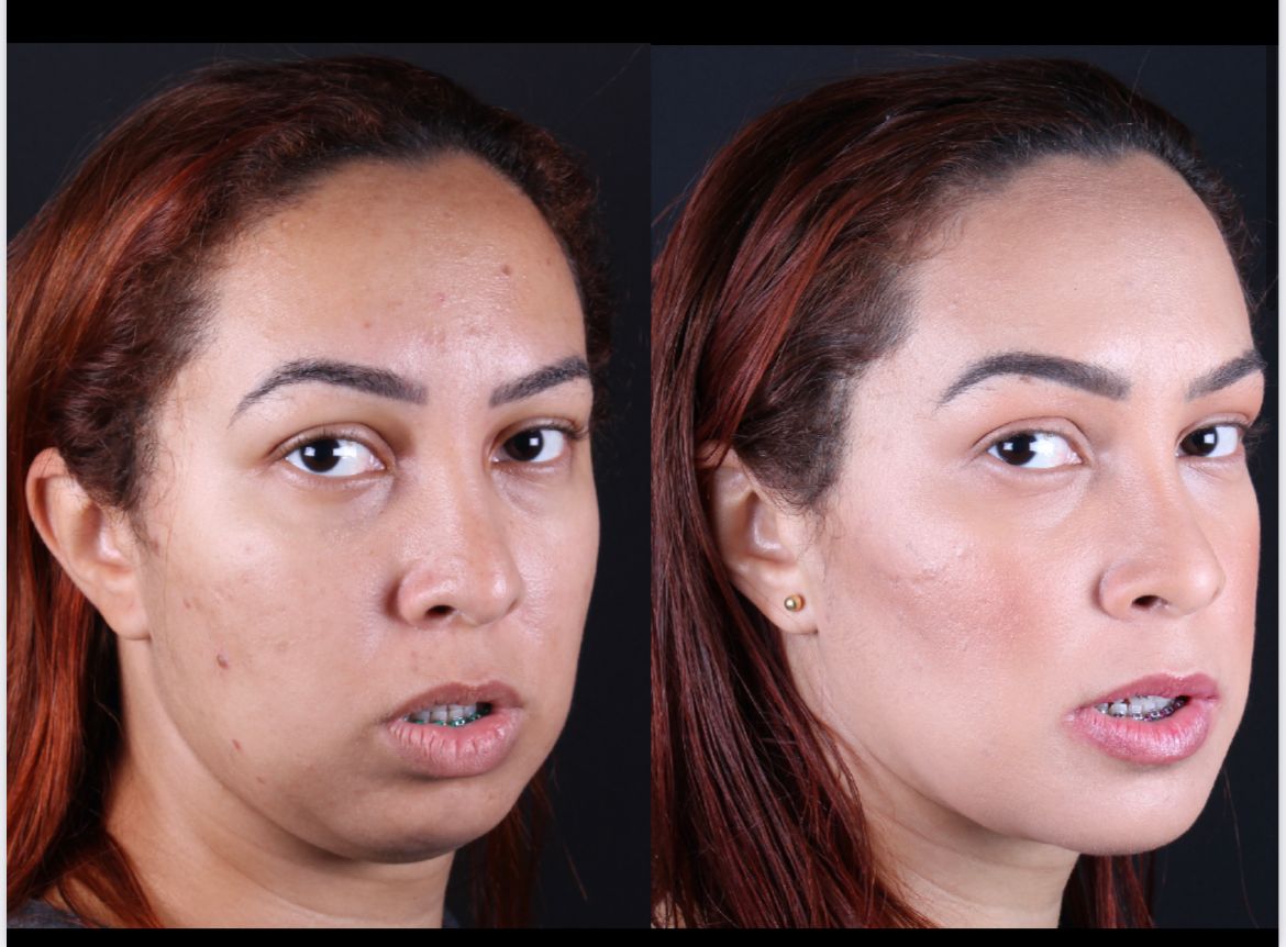 Frederico Carnevale-3