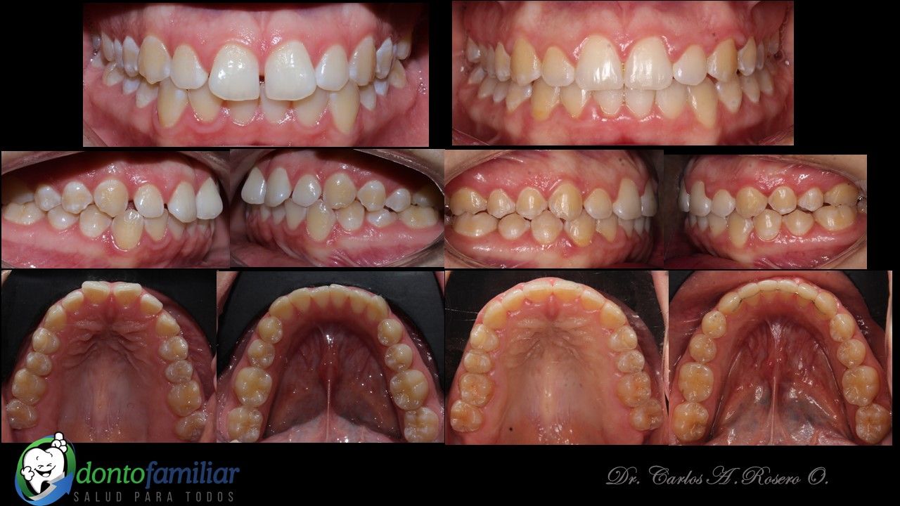 Carlos Augusto Rosero Ordoñez-2