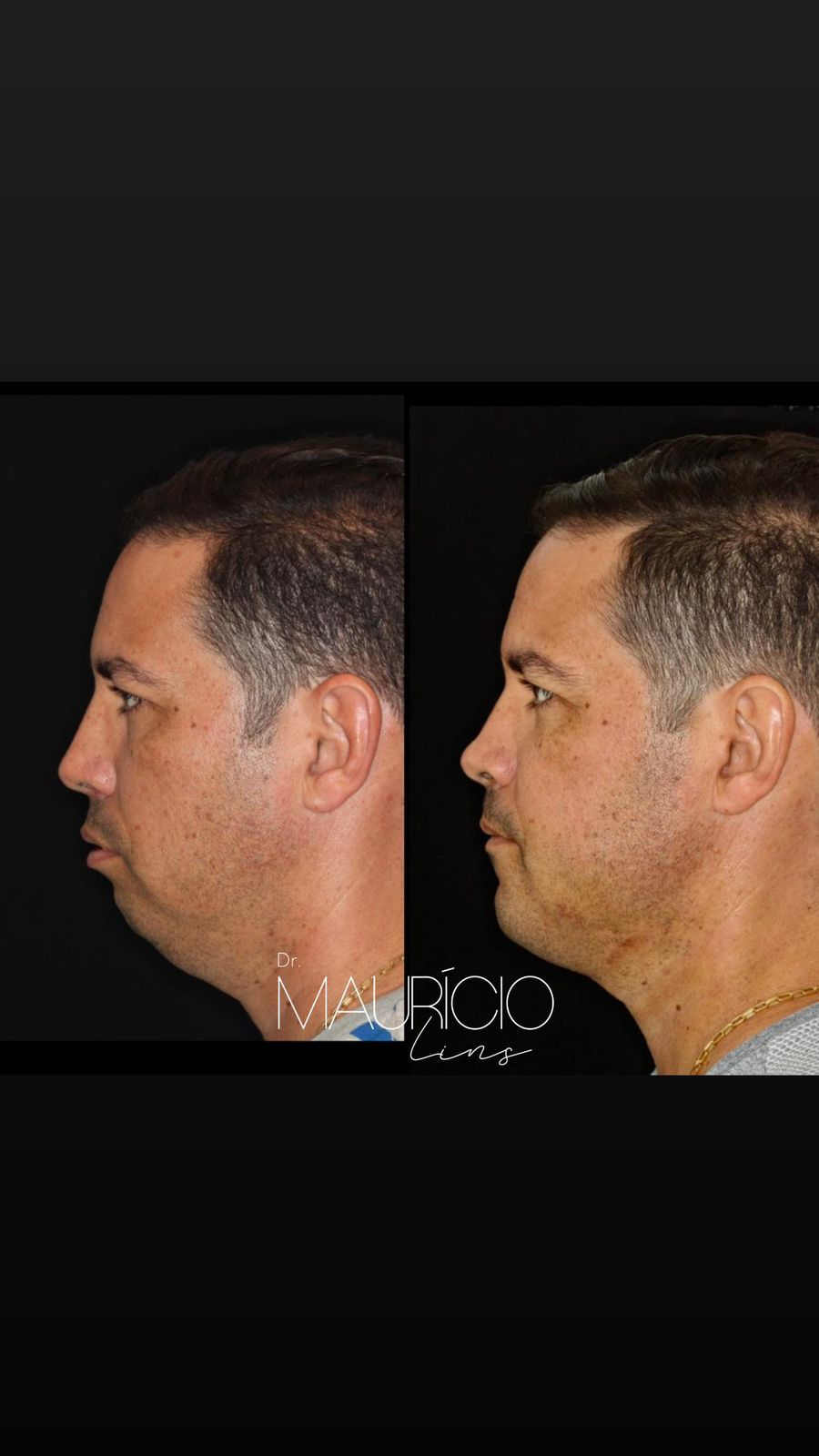 Mauricio Lins Moura-2