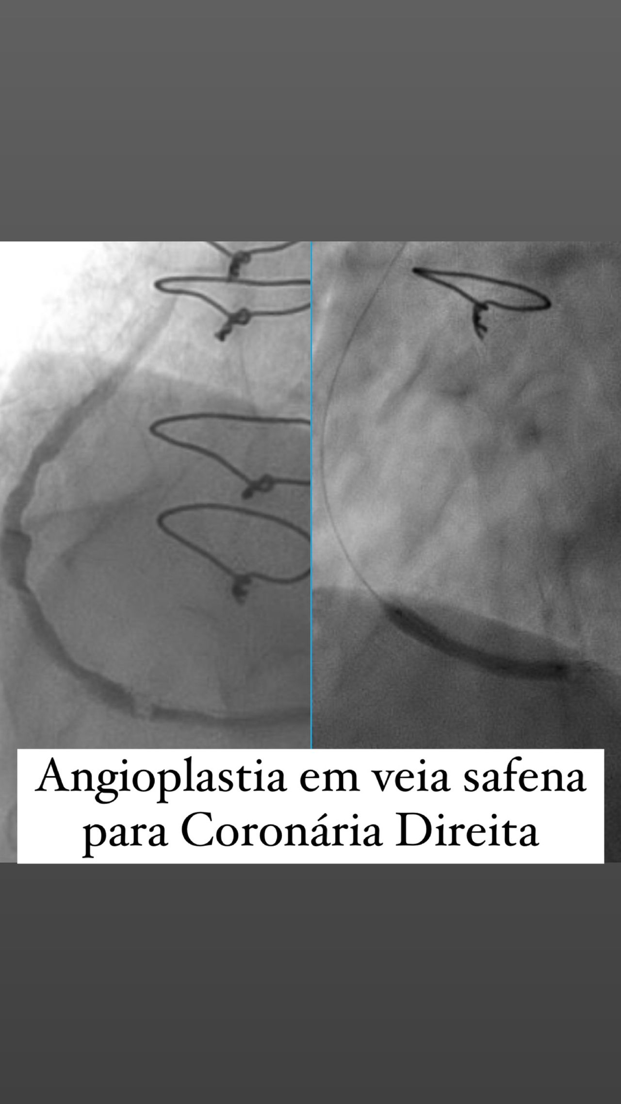 Diogo Antônio Gomes Tiago-4