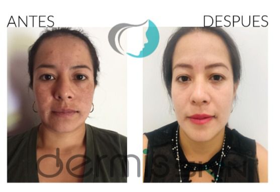 Carlos Alberto Ceron Gomez-8