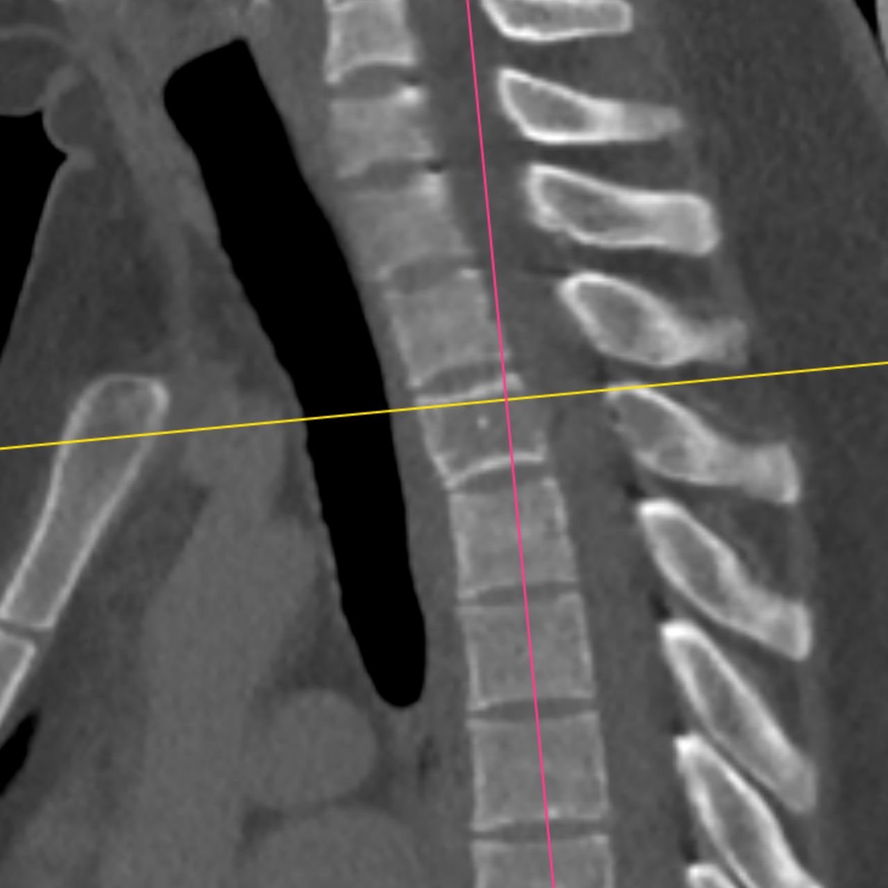 David Tafur Muñoz-2485