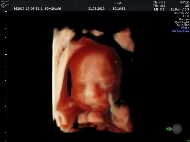 Raul Javier Banderas Pumarino-25