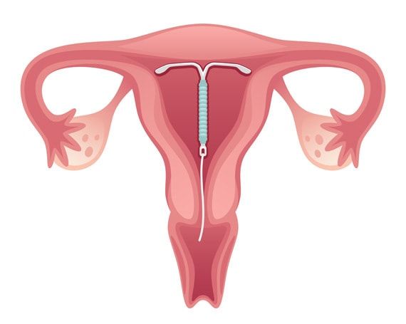 Jessica Pedraza Villanueva-11