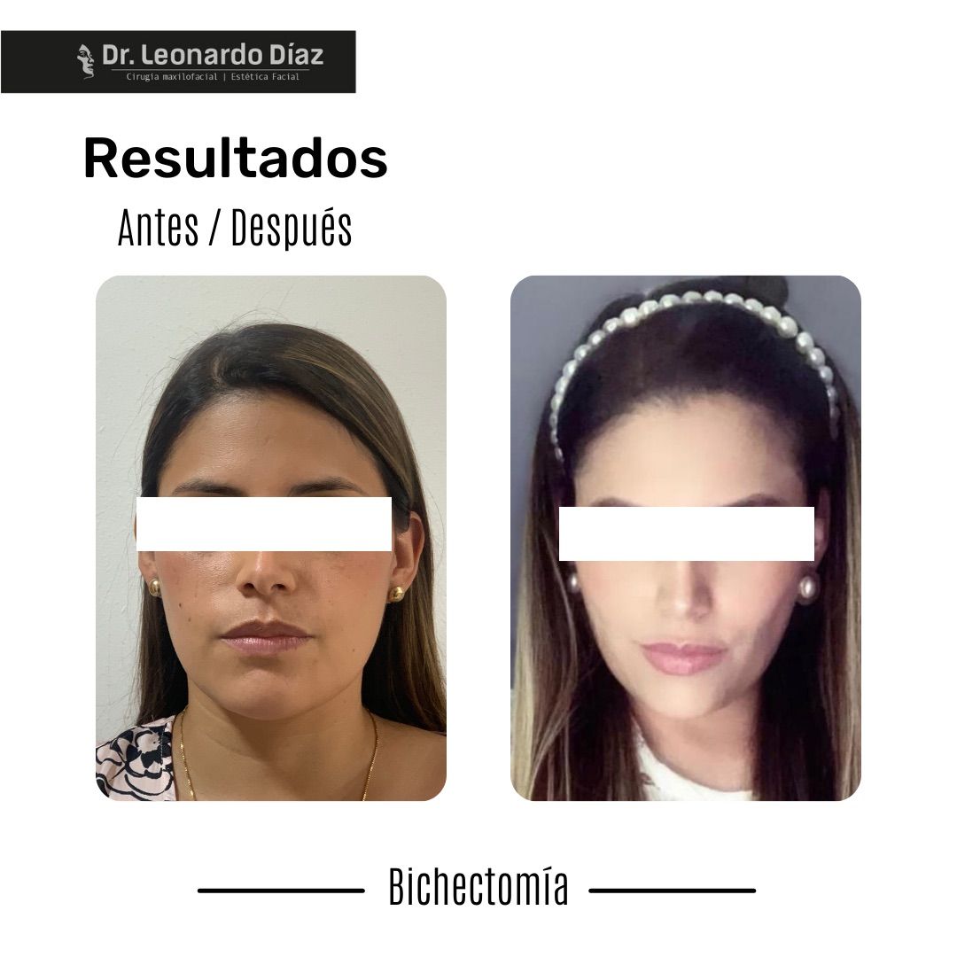 Leonardo Diaz Martínez-6