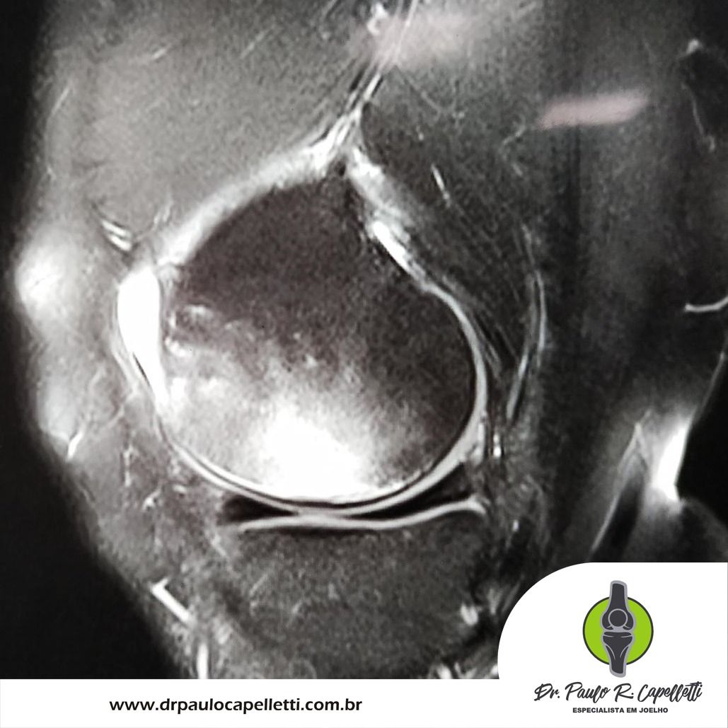 Paulo Roberto Capelletti-80