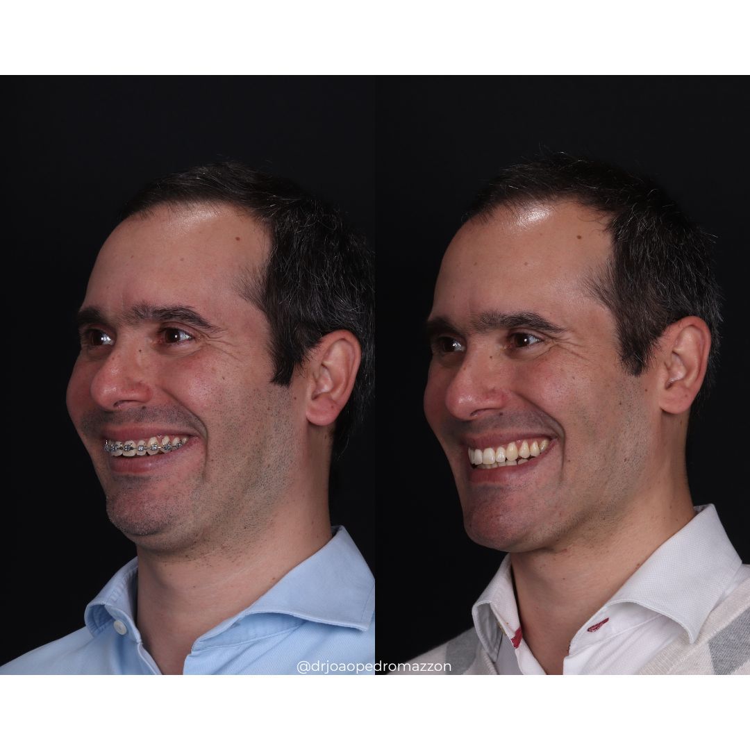 João Pedro Paulino Mazzon-53