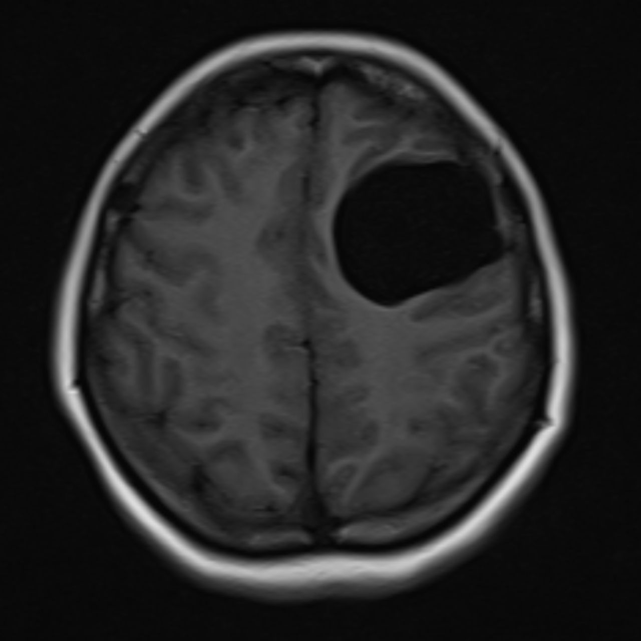 David Tafur Muñoz-2160