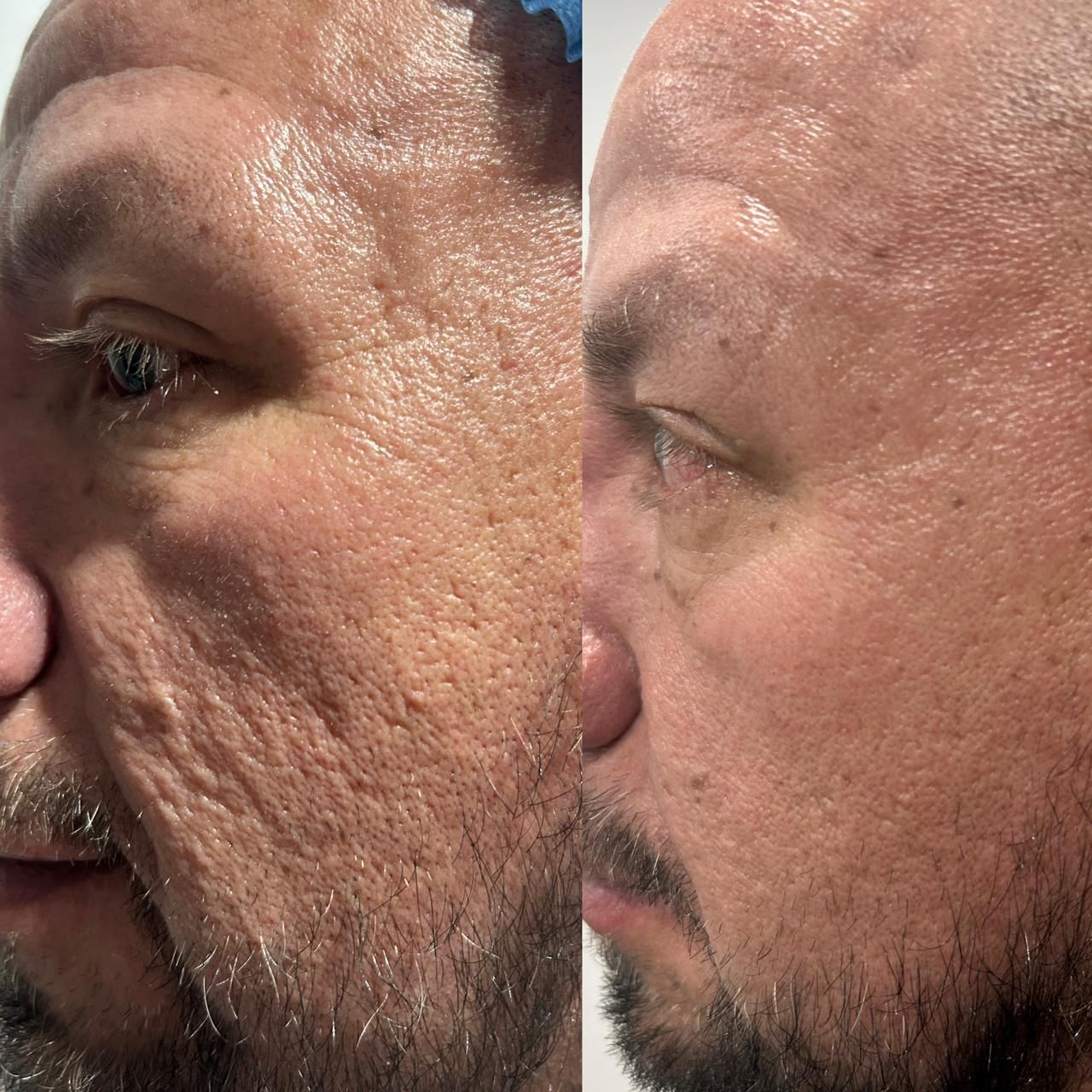 Heida Liceth Vega Vargas-7