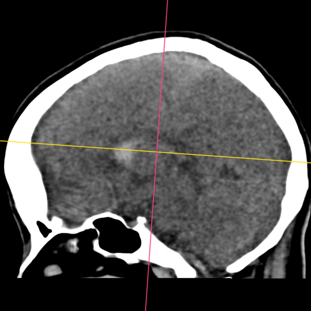 David Tafur Muñoz-1987
