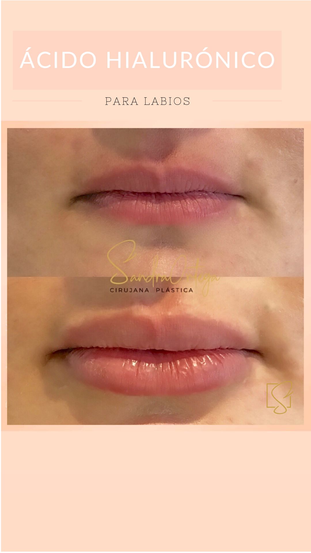 Sandra Viviana Ortega Trejos-38