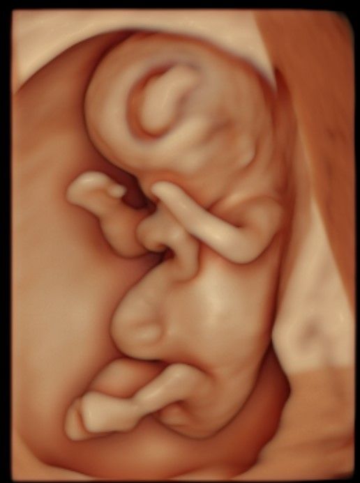 Charles Schwantz De Lima-4