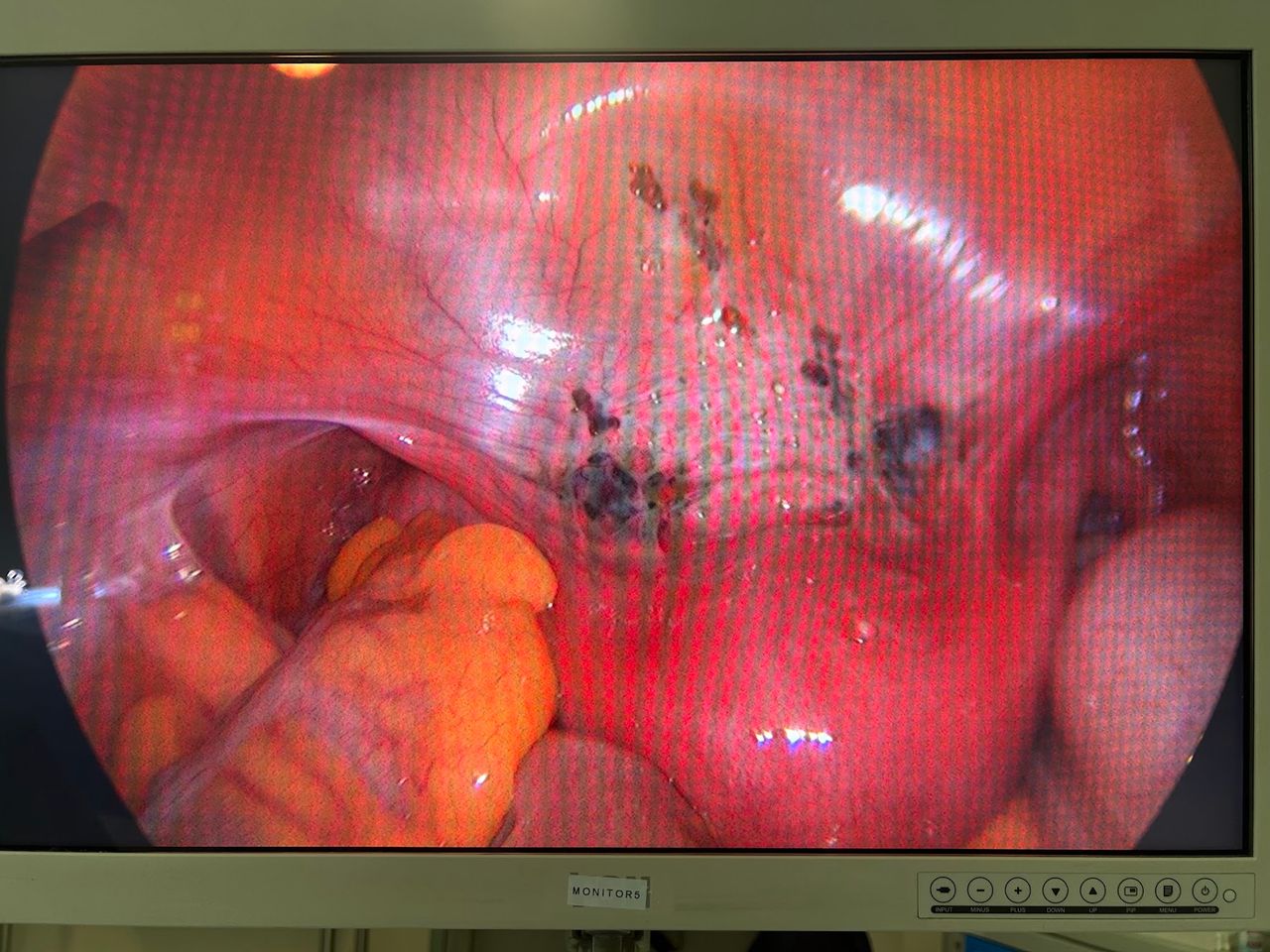 Adalberto Cesario Pereira Junior-38