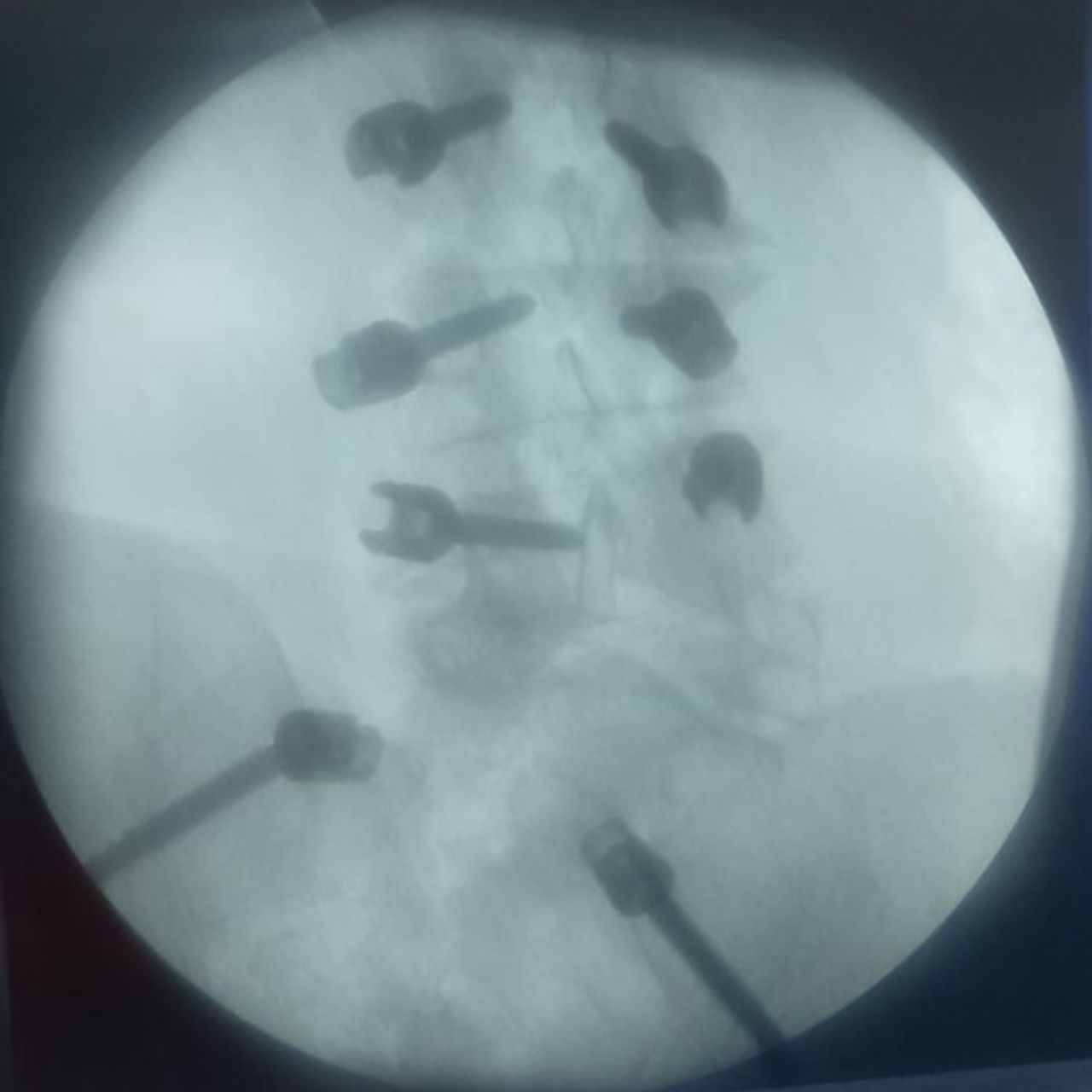 David Tafur Muñoz-2065