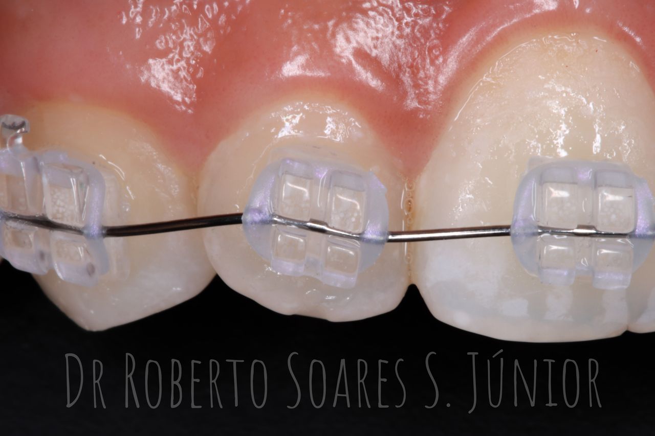 Roberto Soares Da Silva Júnior-8