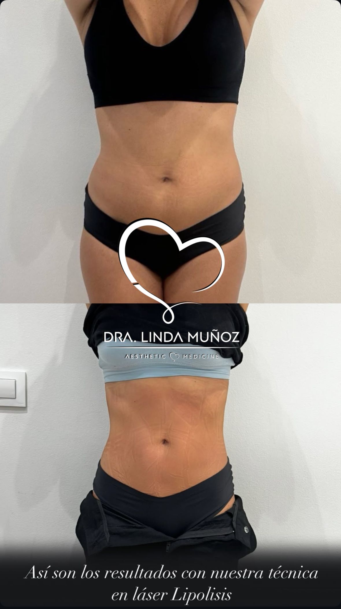 Linda Muñoz-18