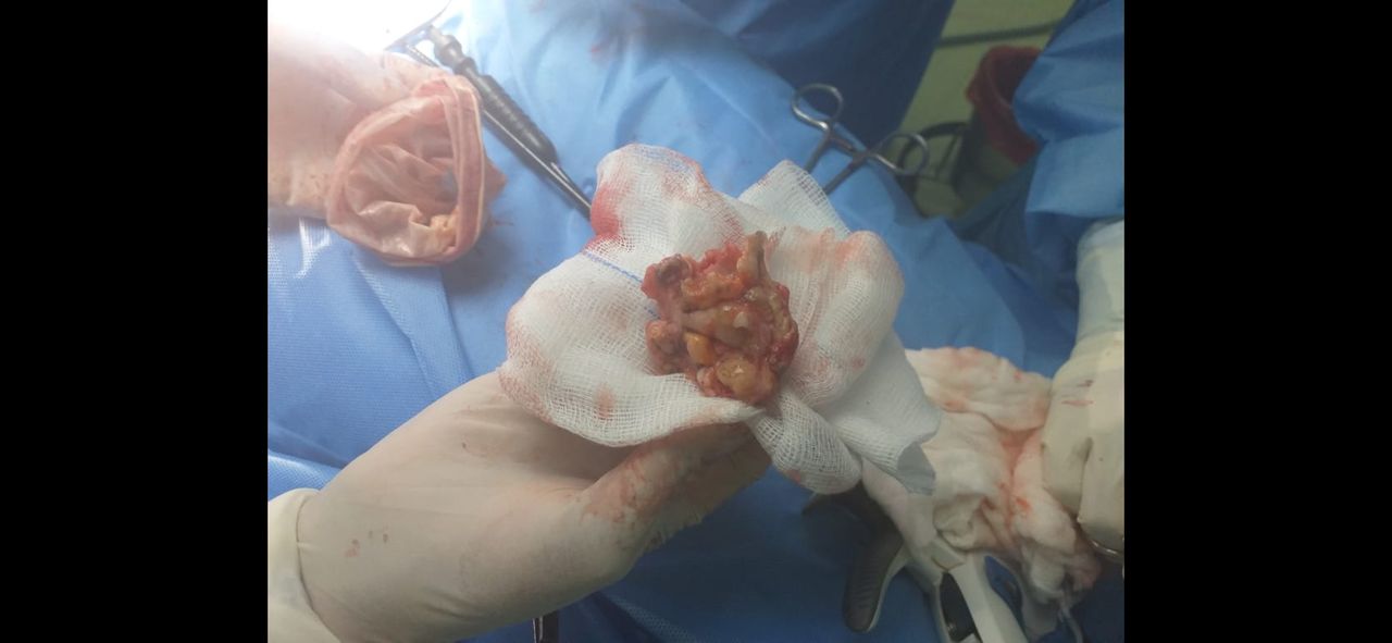 María Denisse Alvarez Huanca-8