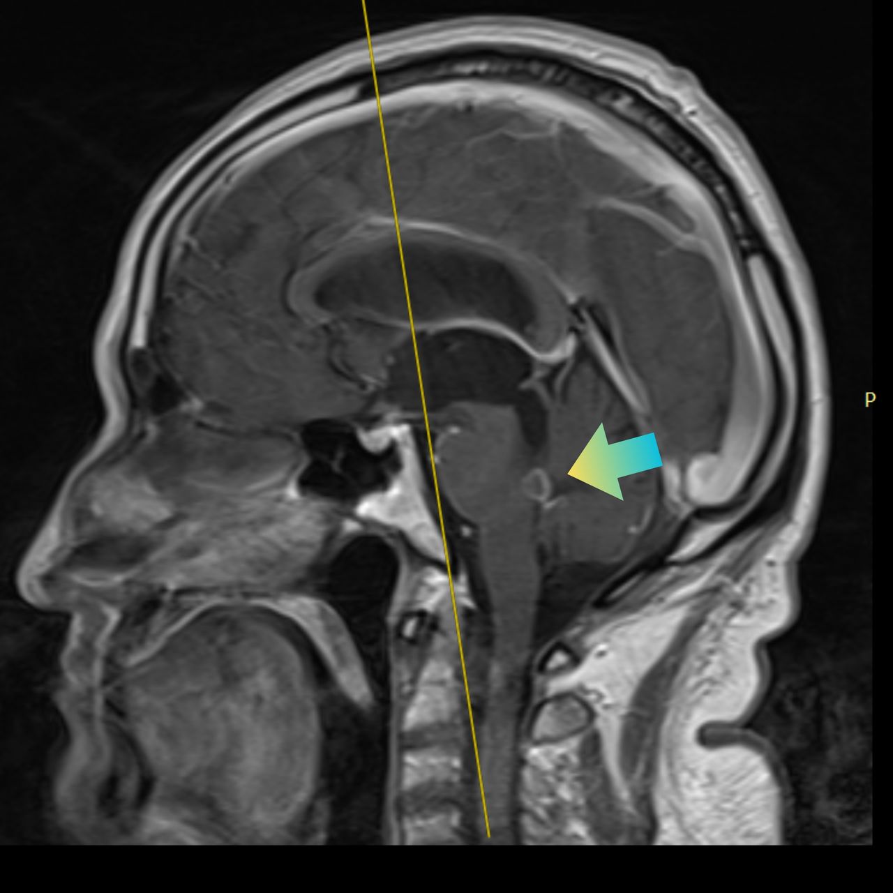 David Tafur Muñoz-2403