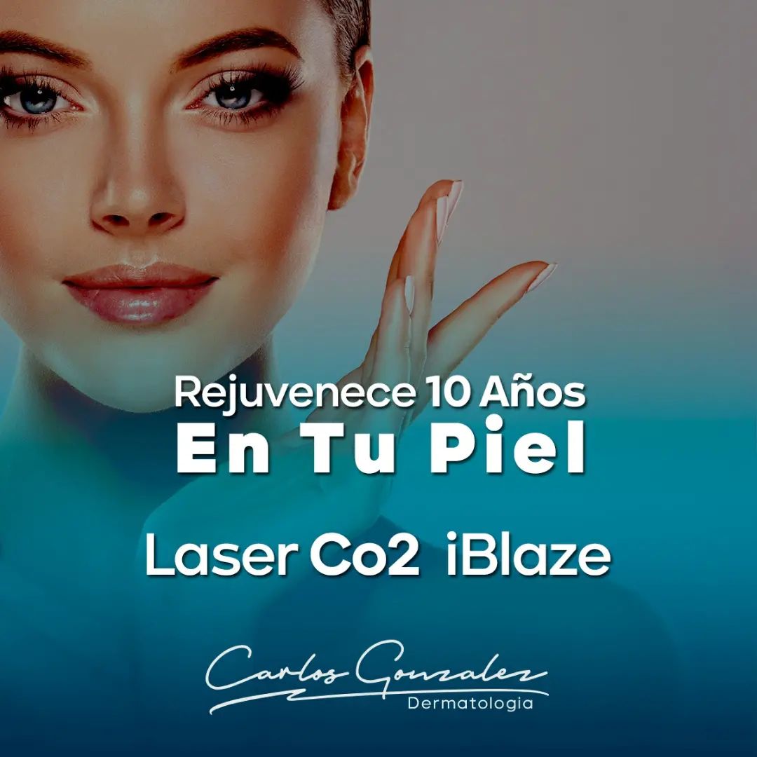 Carlos Gonzalez Montealegre-7