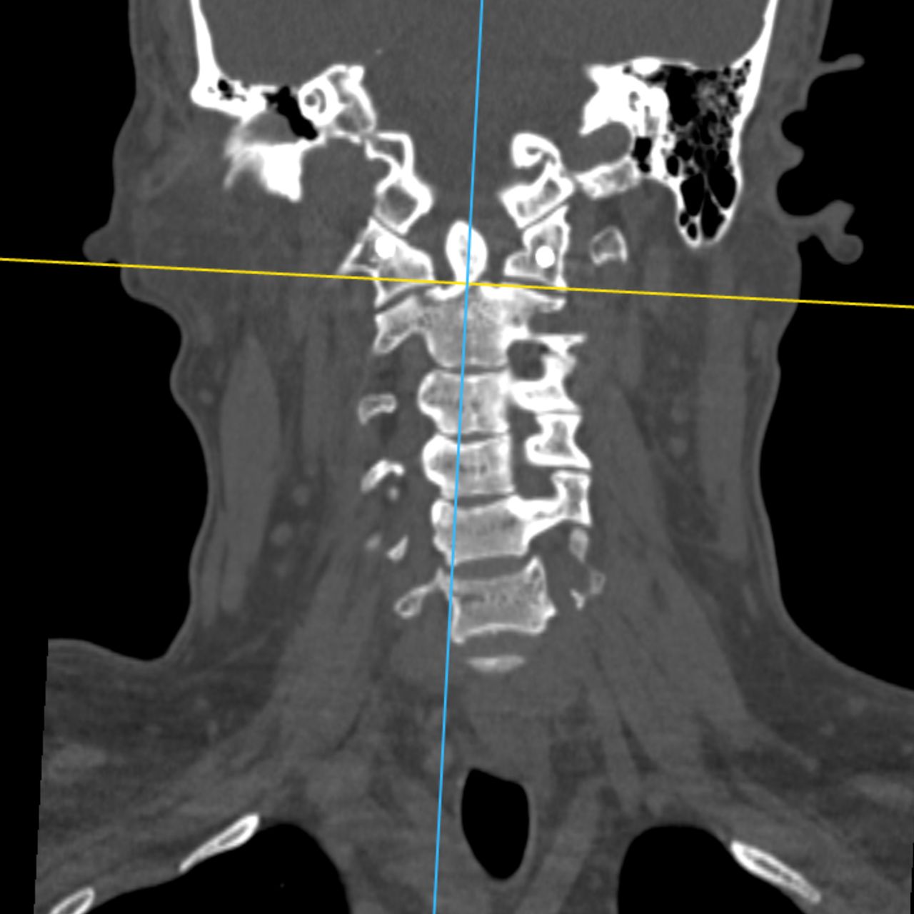 David Tafur Muñoz-1765