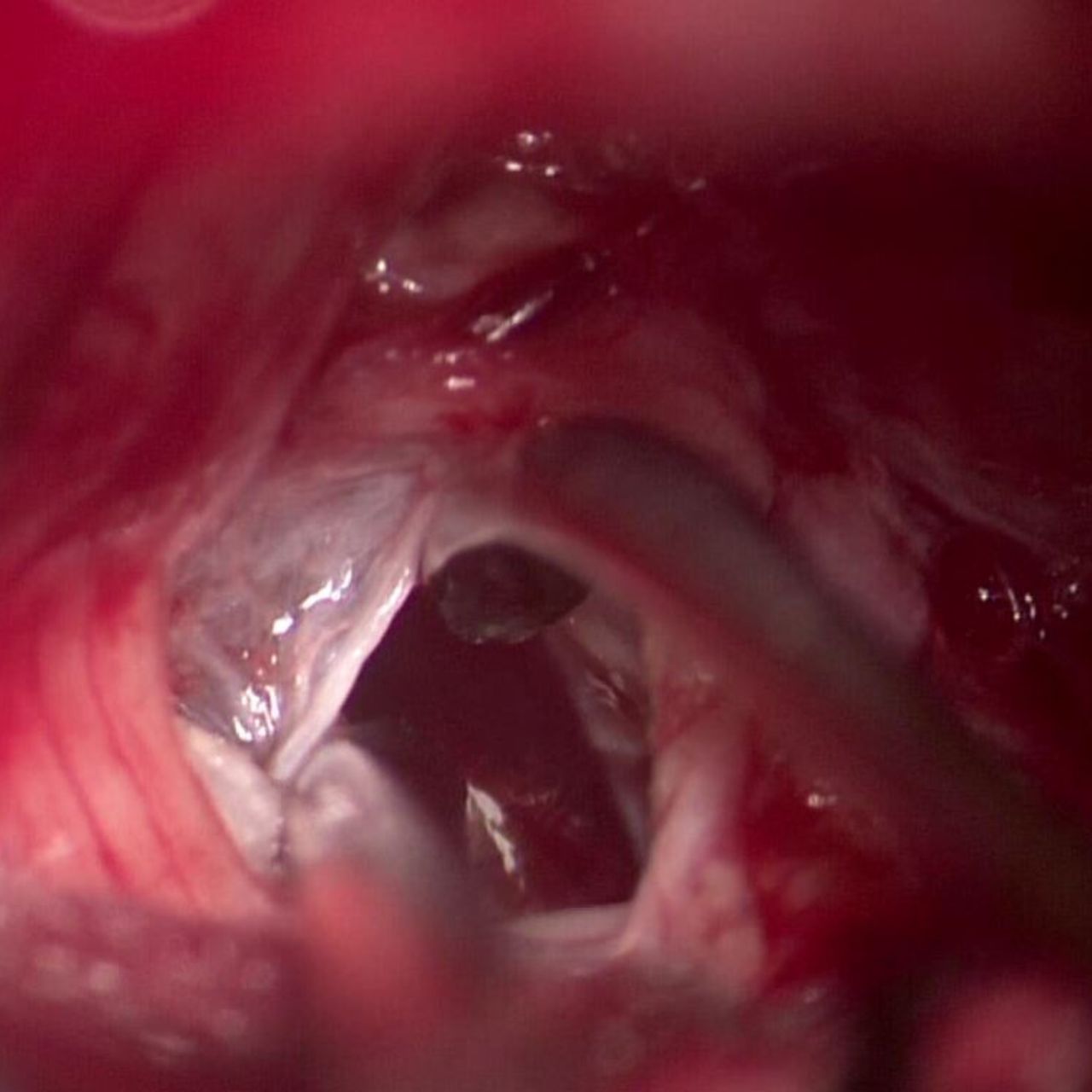 David Tafur Muñoz-1306