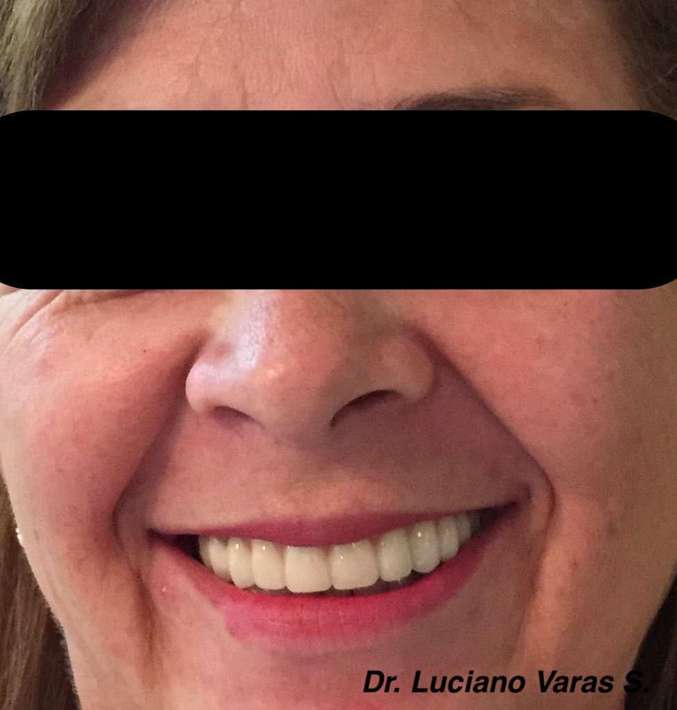 Luciano Varas Salinas-21