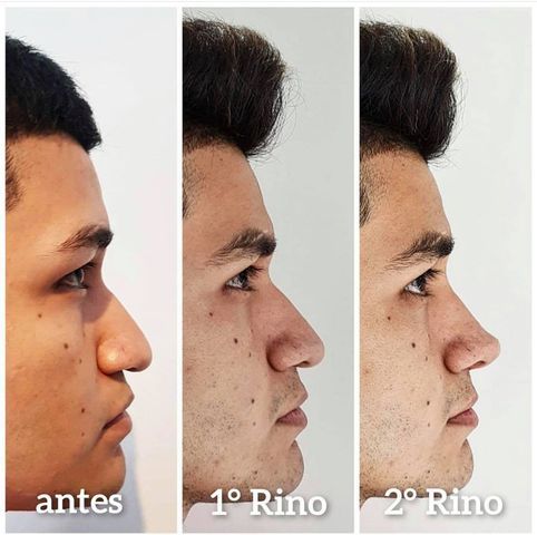 Jhonatan Oyola Farfán-24