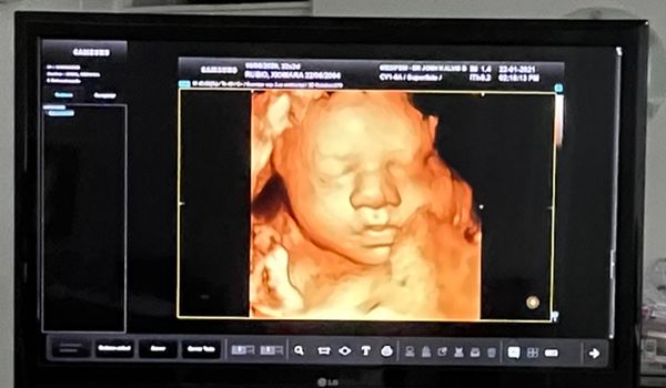 Jonh Harold Alvis Botello-6