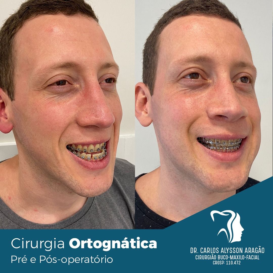 Carlos Alysson Aragão-16