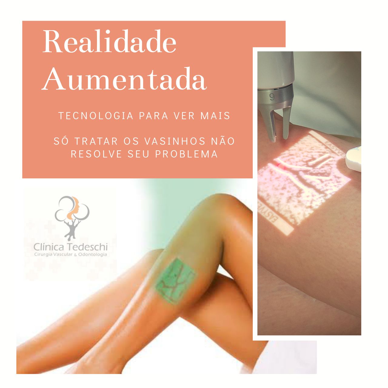 Wagner Tedeschi Filho-7