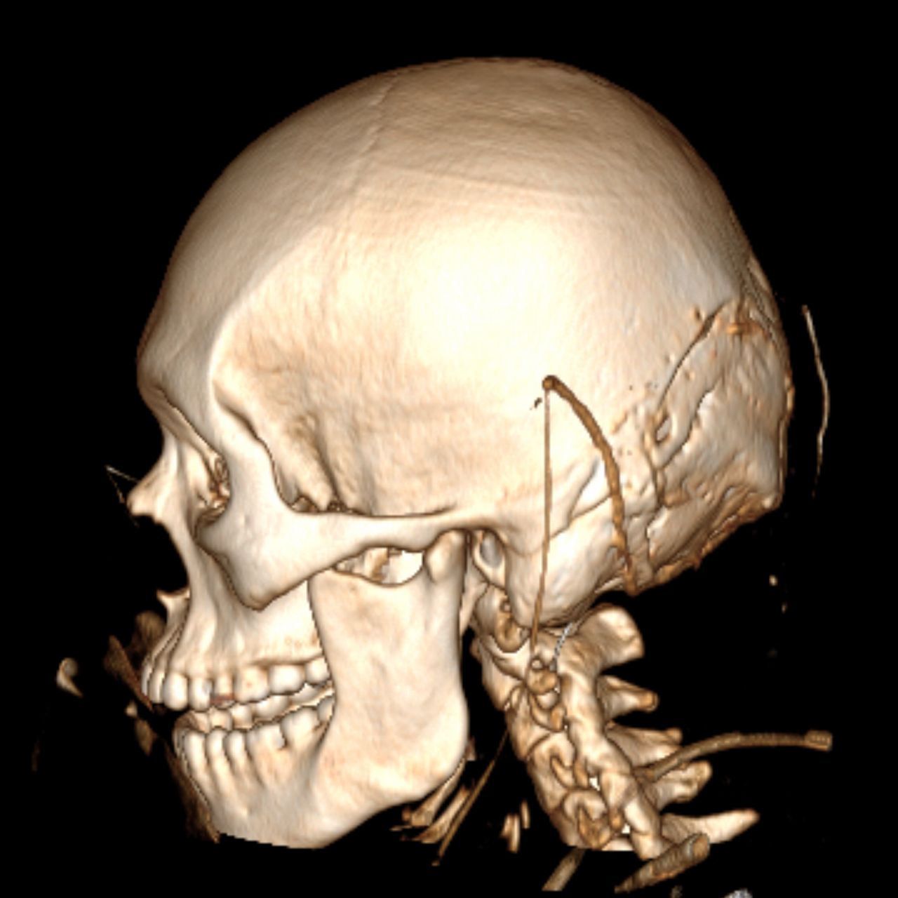 David Tafur Muñoz-1201