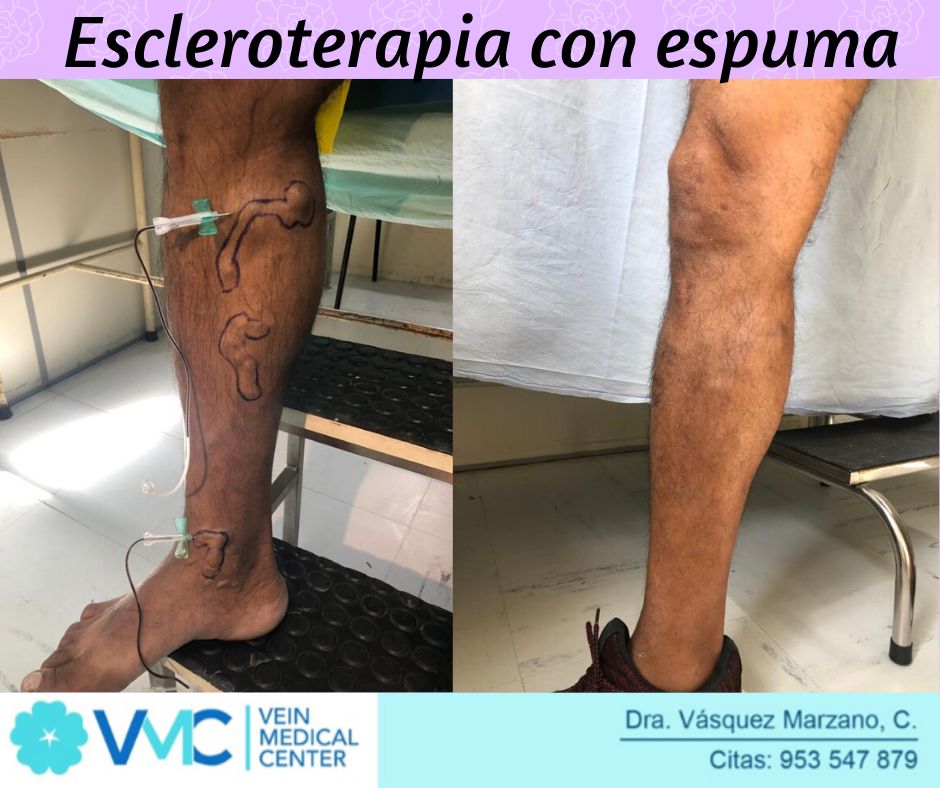 Cindy Vásquez Marzano-21